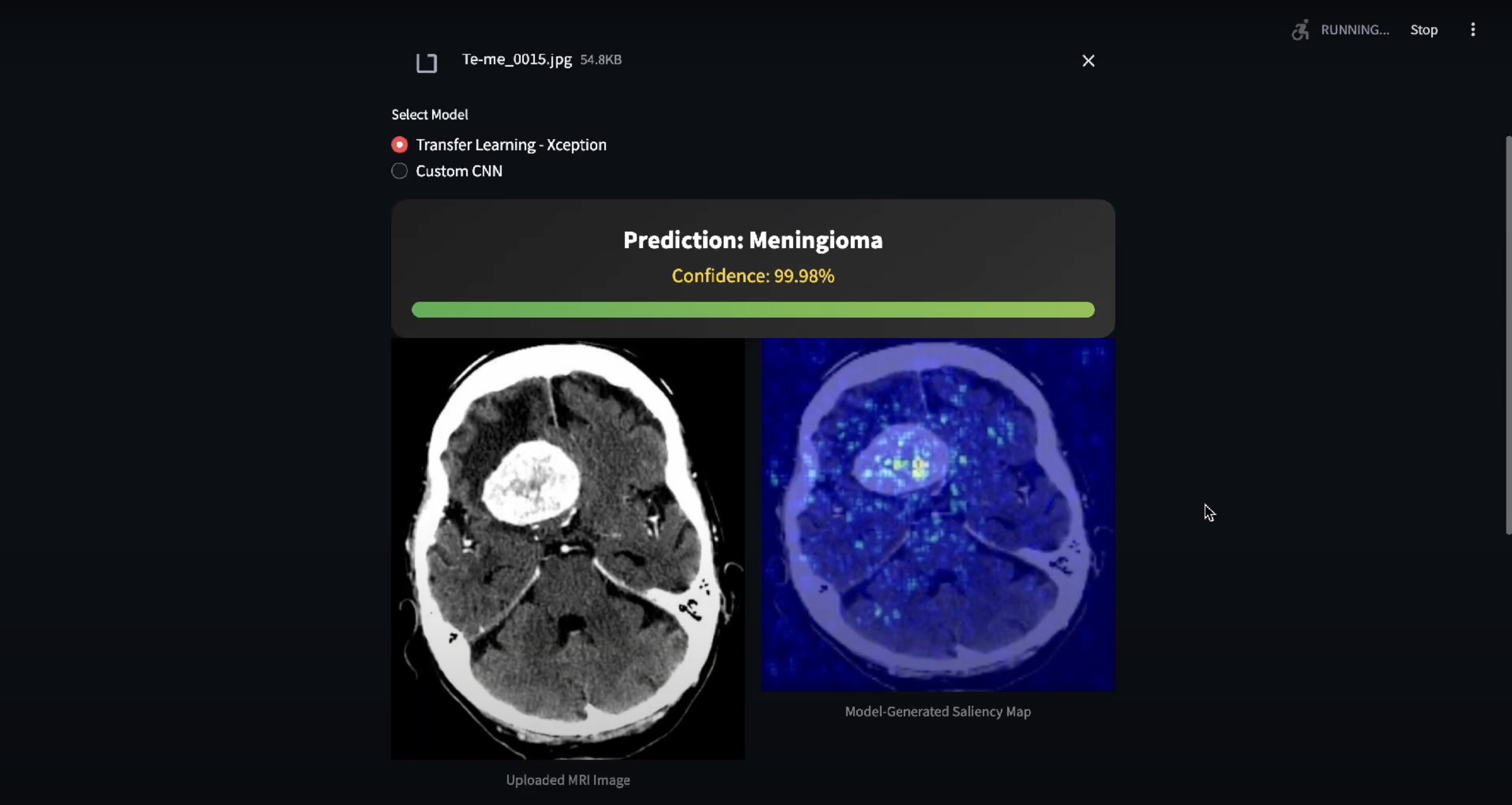 Brain-Tumor-Classification-with-Neural-Networks